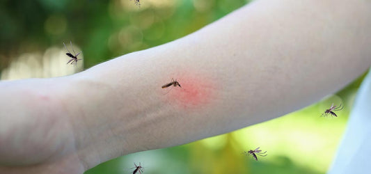 Mega-Catch Mosquito Trap Placement